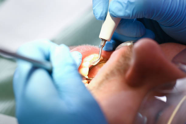 Best Emergency Root Canal Therapy in Gra Forks Af, ND